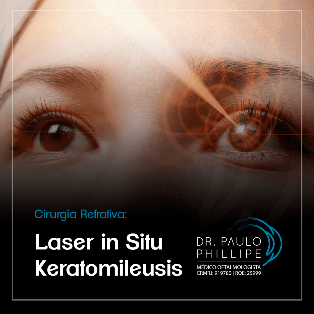 Cirurgia Refrativa Laser In Situ Keratomileusis Blog Do Dr Paulo